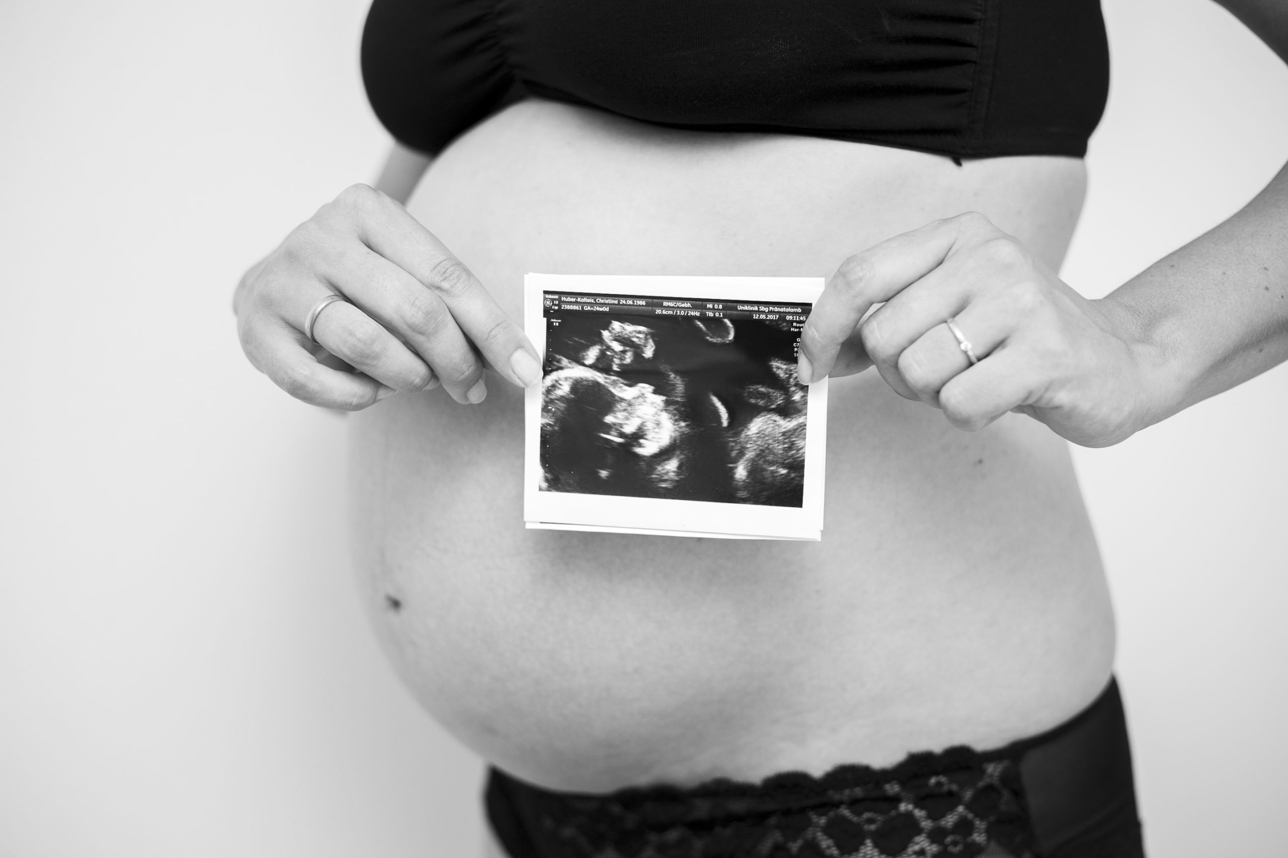 EH Fotografie Babyfotografie Ultraschall